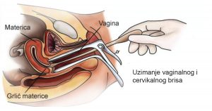 Priprema za uzimanje genitalnih briseva 1 genitalnih briseva