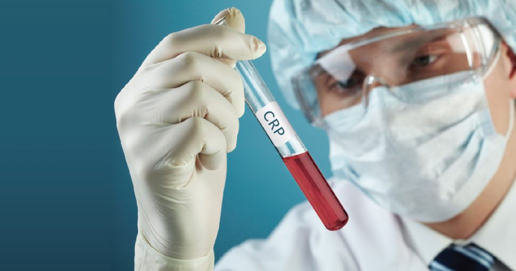 Stop gripu! – KKS i CRP pomoć lekaru u dijagnostici 4 CRP