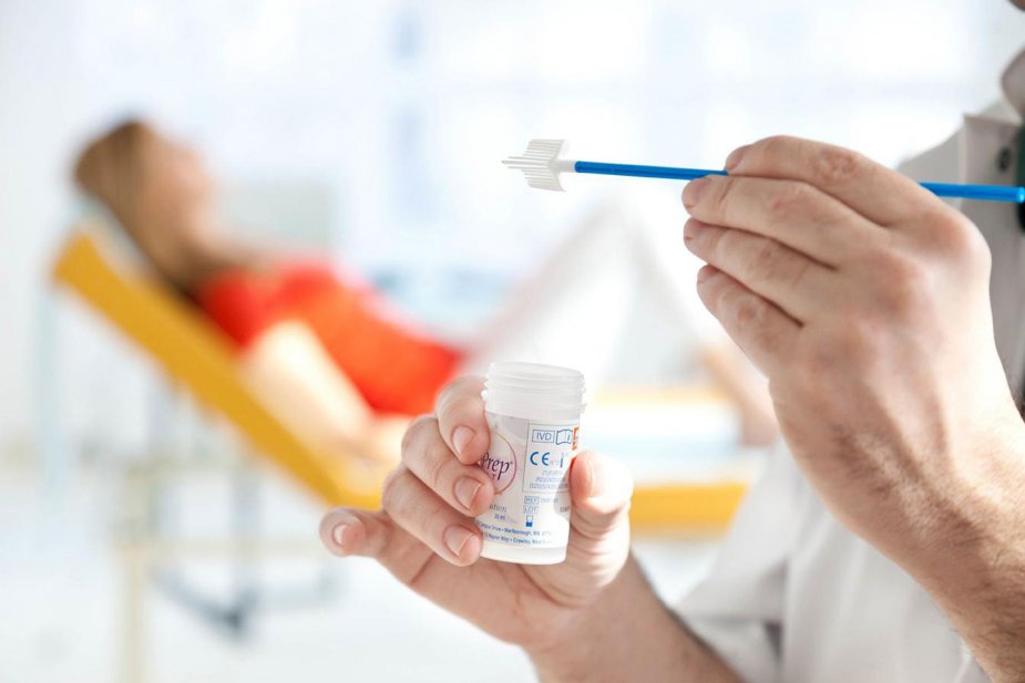 Šta je Humani Papiloma virus? HPV genotipizacija 3 priprema za uzorkovanje za papa test
