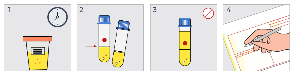 Uputstvo za sakupljanje urina za peptiduriju 1 Uputstvo za sakupljanje urina za peptiduriju2