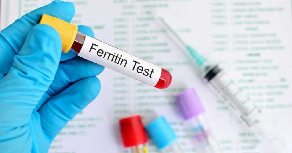 FERITIN - važan u dijagnostici anemije uzrokovane nedostatkom gvožđa 3 feritin analiza