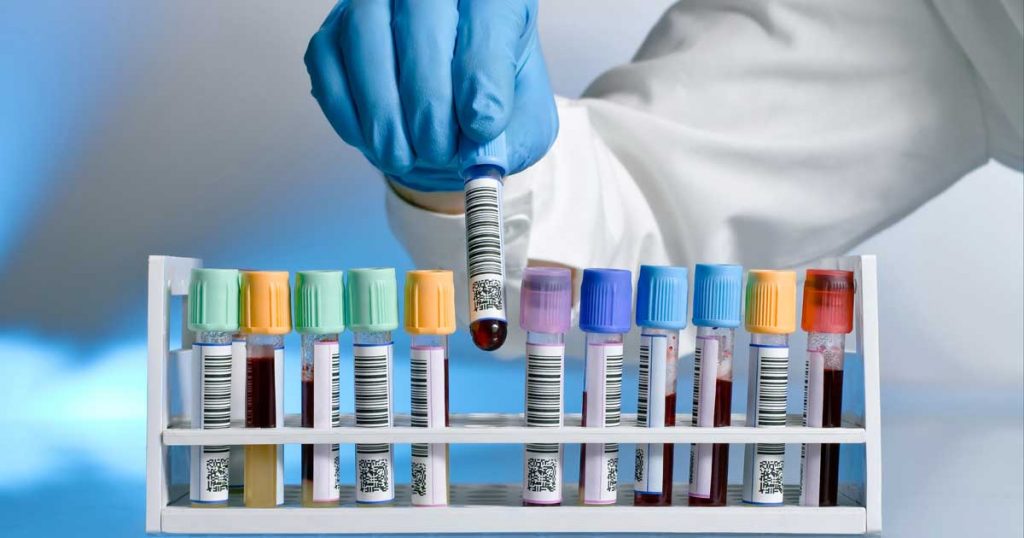 Inhibin B - procena folikularne rezerve jajnika i njihove funkcije 2 Beta HCG test